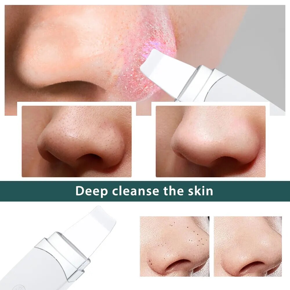 Hailicare Ultrasonic Peeling Machine Skin Care Facial Cleanser